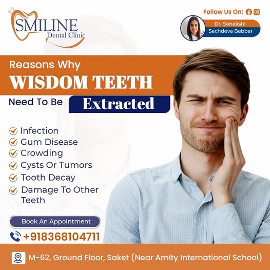 Wisdom Tooth Extraction